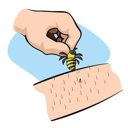 Yellow Jackets and How To Deal With Them