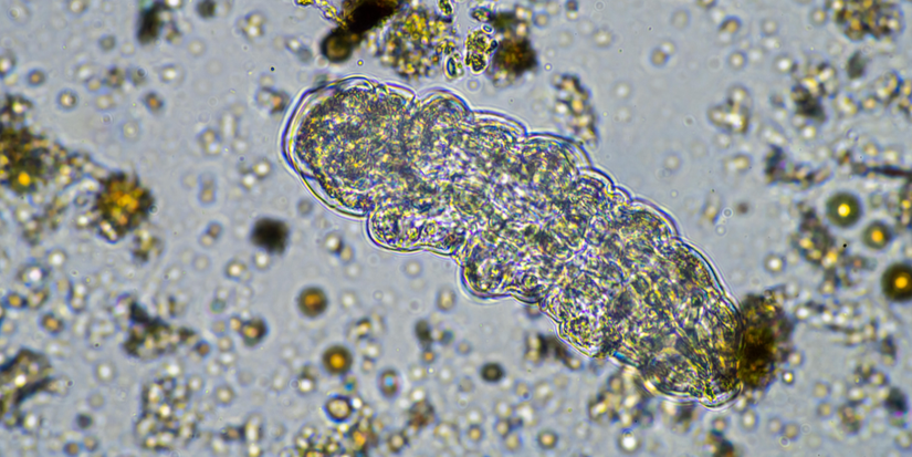 The Gut-Garden Connection: How Soil Impacts Gut Health